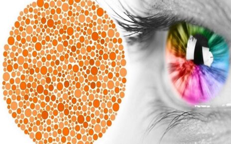 Bệnh mù màu gây ảnh hưởng đến chất lượng cuộc sống của bệnh nhân