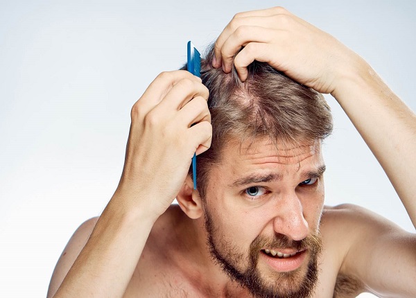 Nhuộm tóc có thể gây kích ứng cho da đầu và mắt